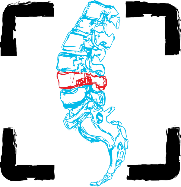 Back Breakers